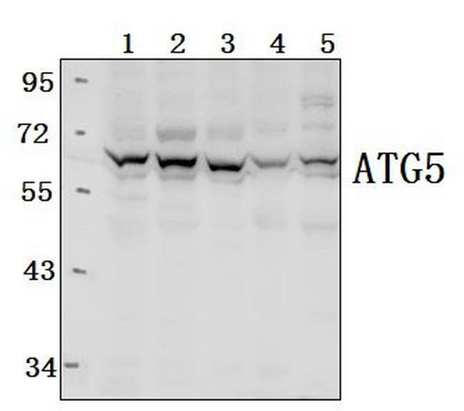 ATG5 Antibody in Western Blot (WB)