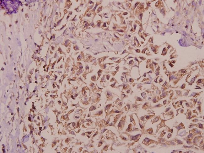 Bax Antibody in Immunohistochemistry (Paraffin) (IHC (P))