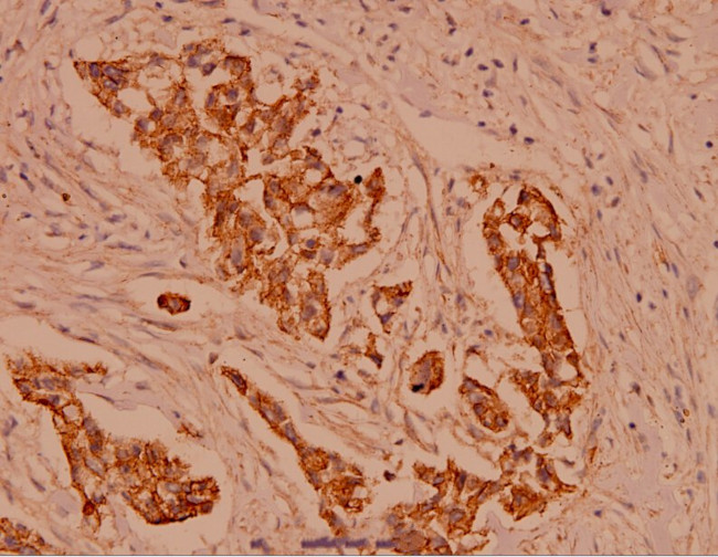 gamma Catenin Antibody in Immunohistochemistry (Paraffin) (IHC (P))