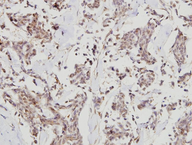 HDAC7 Antibody in Immunohistochemistry (Paraffin) (IHC (P))