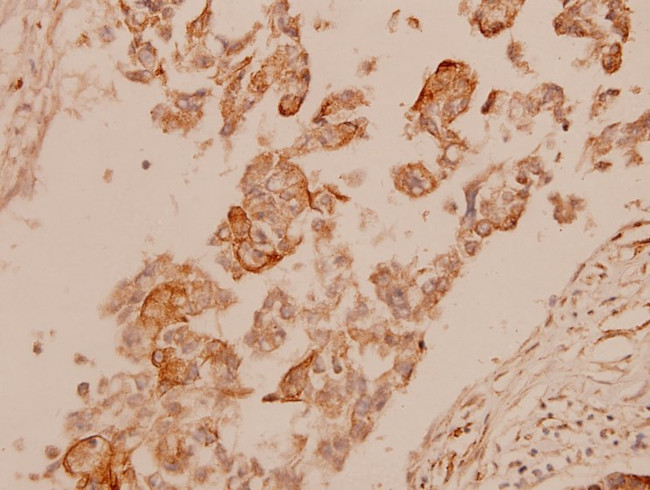Cytokeratin 15 Antibody in Immunohistochemistry (Paraffin) (IHC (P))