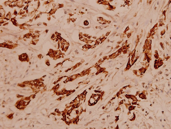 Cytokeratin 16 Antibody in Immunohistochemistry (Paraffin) (IHC (P))