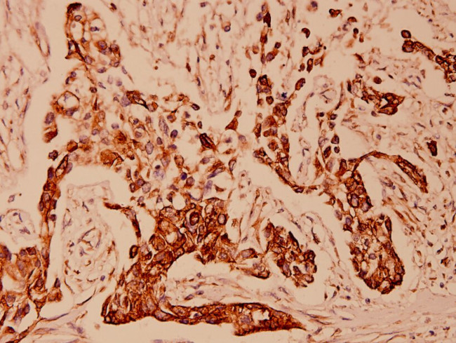 Cytokeratin 18 Antibody in Immunohistochemistry (Paraffin) (IHC (P))