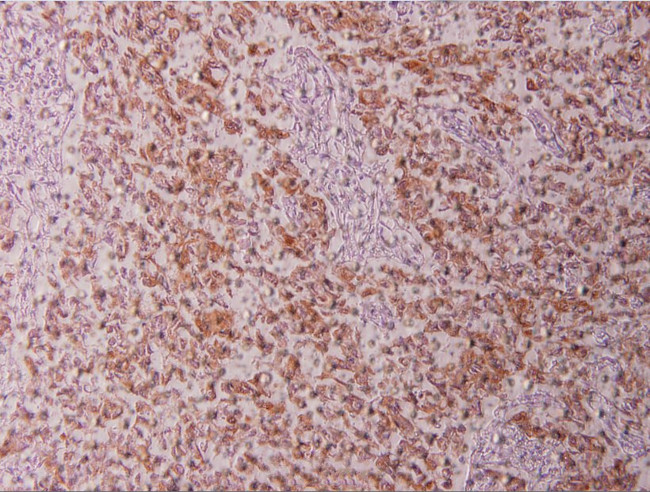 Cytokeratin 18 Antibody in Immunohistochemistry (Paraffin) (IHC (P))