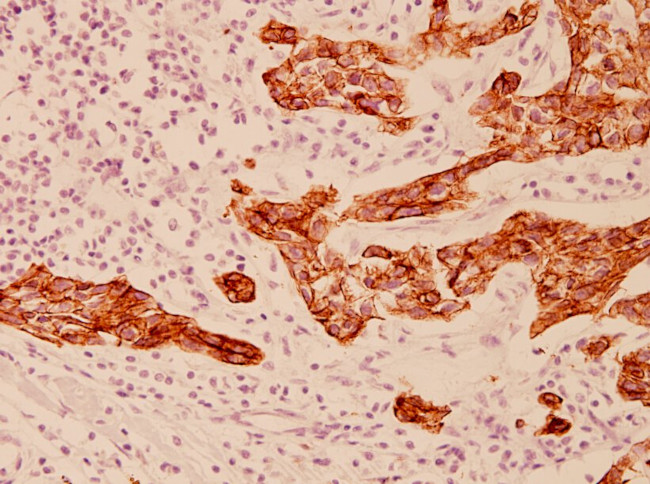 Cytokeratin 19 Antibody in Immunohistochemistry (Paraffin) (IHC (P))