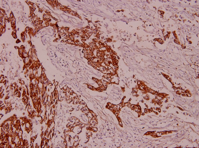 Cytokeratin 8 Antibody in Immunohistochemistry (Paraffin) (IHC (P))