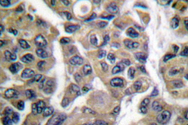 MAGE1 Antibody in Immunohistochemistry (Paraffin) (IHC (P))