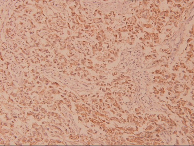 MEK2 Antibody in Immunohistochemistry (Paraffin) (IHC (P))