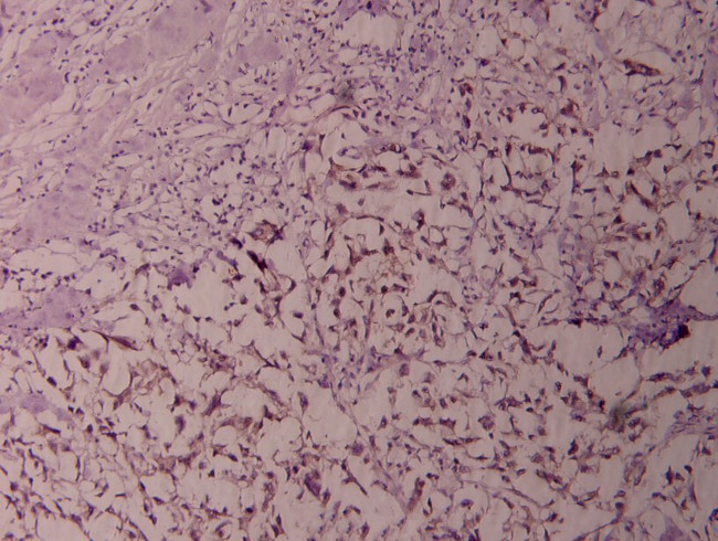 NFkB p100 Antibody in Immunohistochemistry (Paraffin) (IHC (P))