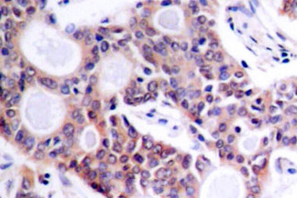 NFkB p100 Antibody in Immunohistochemistry (Paraffin) (IHC (P))