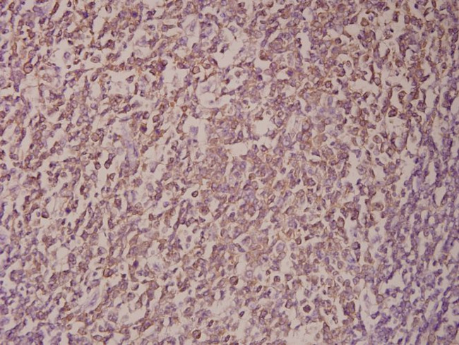 p14ARF Antibody in Immunohistochemistry (Paraffin) (IHC (P))