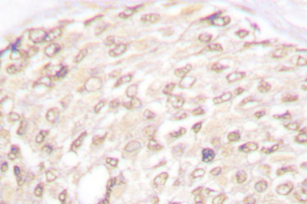 CDKN2C Antibody in Immunohistochemistry (Paraffin) (IHC (P))