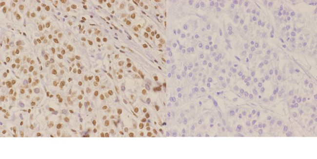 NBS1 Antibody in Immunohistochemistry (Paraffin) (IHC (P))