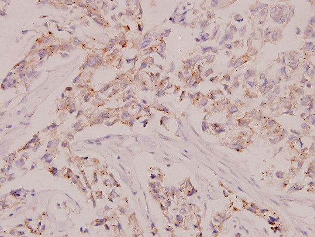 c-Raf Antibody in Immunohistochemistry (Paraffin) (IHC (P))