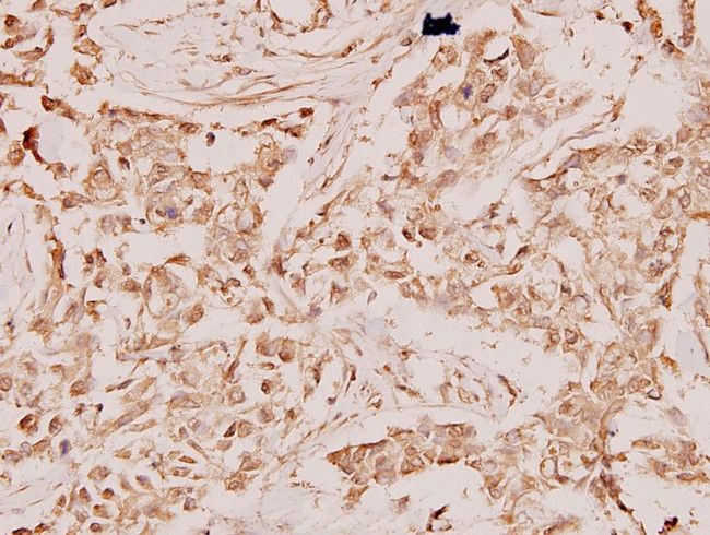 RAN Antibody in Immunohistochemistry (Paraffin) (IHC (P))