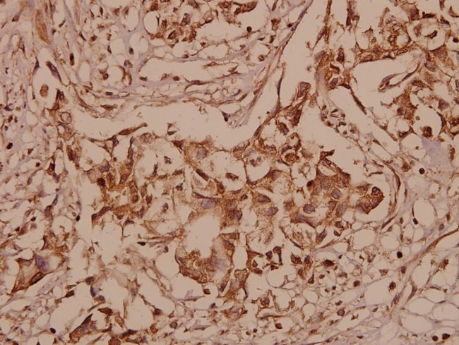 SHP2 Antibody in Immunohistochemistry (Paraffin) (IHC (P))