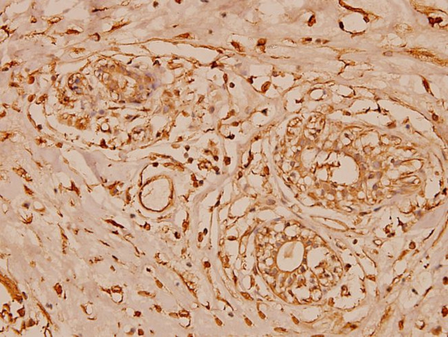 Cystatin B Antibody in Immunohistochemistry (Paraffin) (IHC (P))