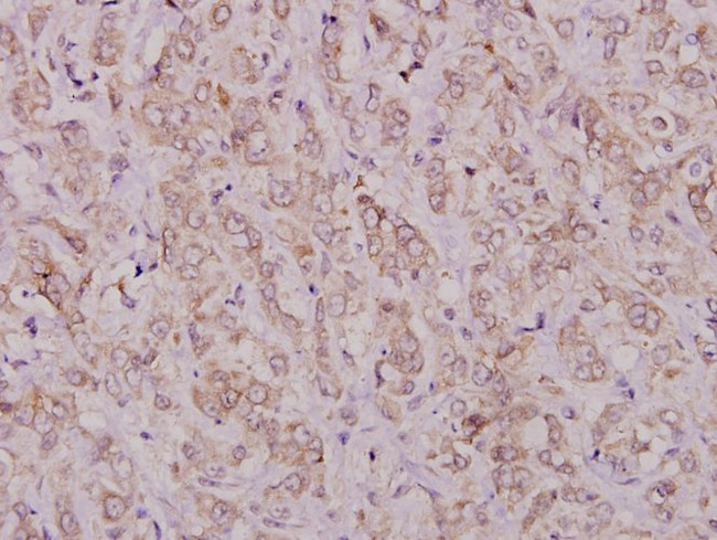 TGF alpha Antibody in Immunohistochemistry (Paraffin) (IHC (P))