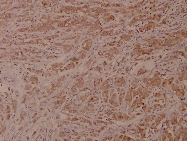 VAV1 Antibody in Immunohistochemistry (Paraffin) (IHC (P))