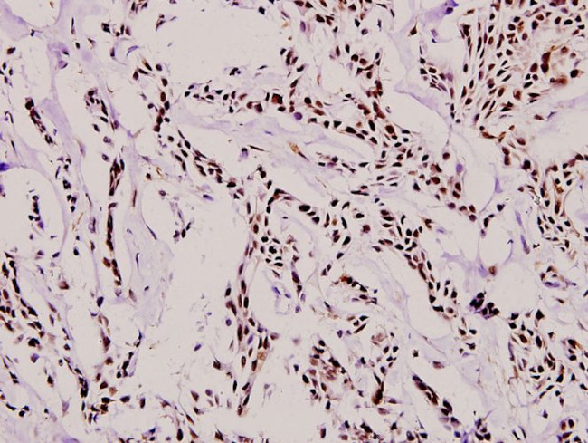 RUNX1 Antibody in Immunohistochemistry (Paraffin) (IHC (P))