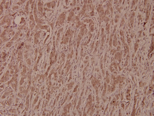 GSK3B Antibody in Immunohistochemistry (Paraffin) (IHC (P))