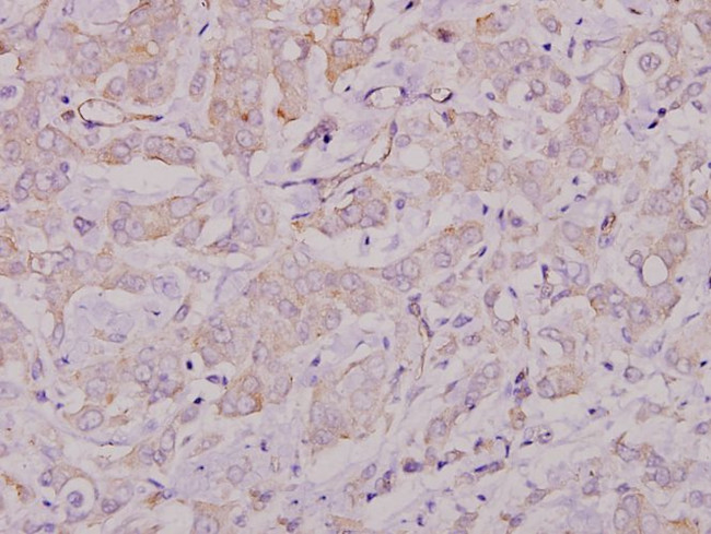 Lyn Antibody in Immunohistochemistry (Paraffin) (IHC (P))