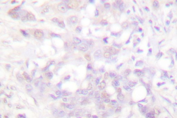 POLR2A Antibody in Immunohistochemistry (Paraffin) (IHC (P))