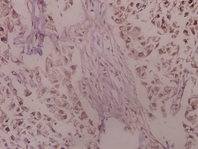 TrkA Antibody in Immunohistochemistry (Paraffin) (IHC (P))