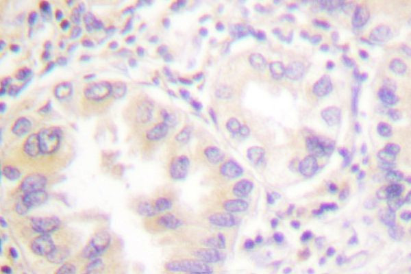 VASP Antibody in Immunohistochemistry (Paraffin) (IHC (P))