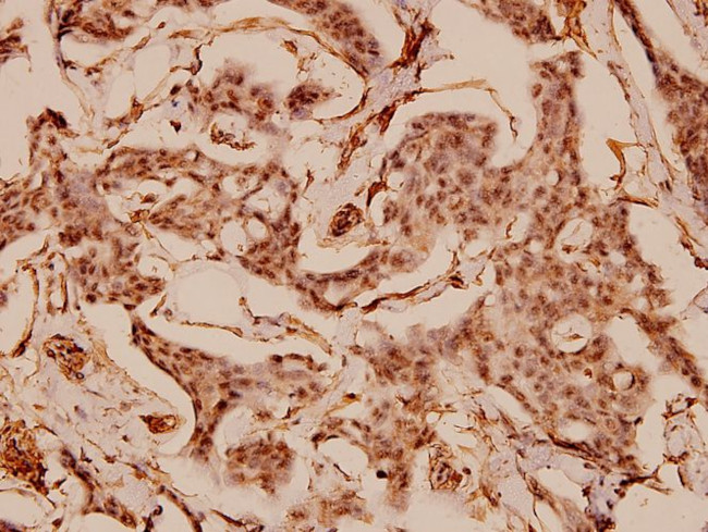 Caldesmon Antibody in Immunohistochemistry (Paraffin) (IHC (P))