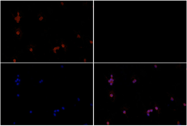 RSK1 Antibody in Immunocytochemistry (ICC/IF)