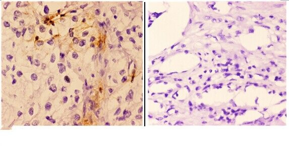 Cardiac Troponin I Antibody in Immunohistochemistry (Paraffin) (IHC (P))