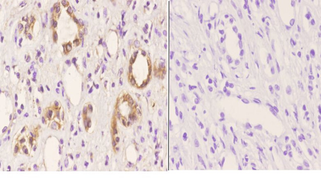 beta Tubulin Antibody in Immunohistochemistry (Paraffin) (IHC (P))