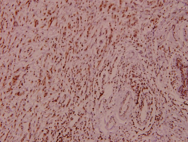 B-Raf Antibody in Immunohistochemistry (Paraffin) (IHC (P))