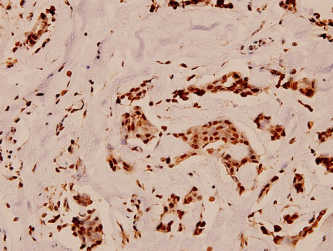 GP130 Antibody in Immunohistochemistry (Paraffin) (IHC (P))