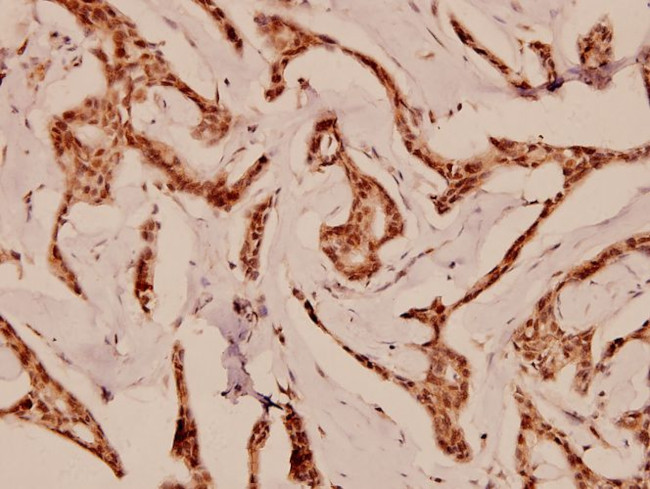 Cdc25B Antibody in Immunohistochemistry (Paraffin) (IHC (P))