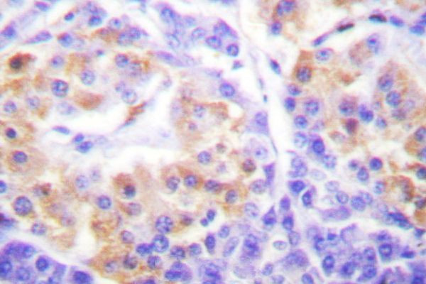 Collagen III Antibody in Immunohistochemistry (Paraffin) (IHC (P))