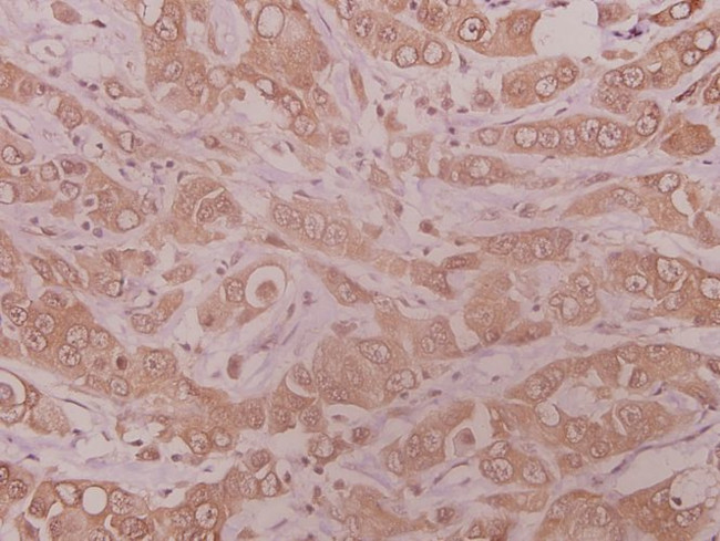 MMP10 Antibody in Immunohistochemistry (Paraffin) (IHC (P))