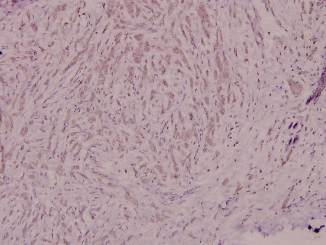 NCF4 Antibody in Immunohistochemistry (Paraffin) (IHC (P))