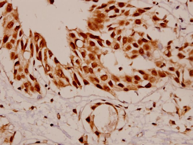 SF1 Antibody in Immunohistochemistry (Paraffin) (IHC (P))