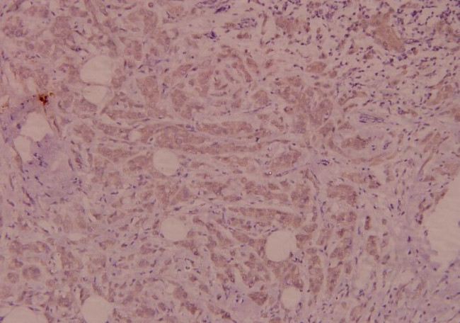 TSC2 Antibody in Immunohistochemistry (Paraffin) (IHC (P))
