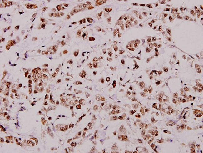 XIAP Antibody in Immunohistochemistry (Paraffin) (IHC (P))