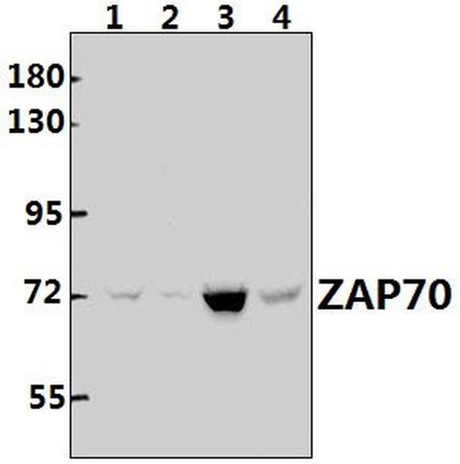 Zap-70 Antibody in Western Blot (WB)