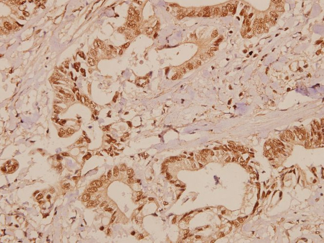 c-Raf Antibody in Immunohistochemistry (Paraffin) (IHC (P))