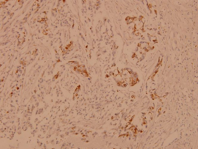CRYAB Antibody in Immunohistochemistry (Paraffin) (IHC (P))
