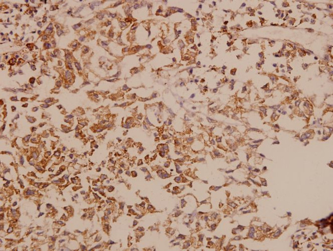 DDX3 Antibody in Immunohistochemistry (Paraffin) (IHC (P))