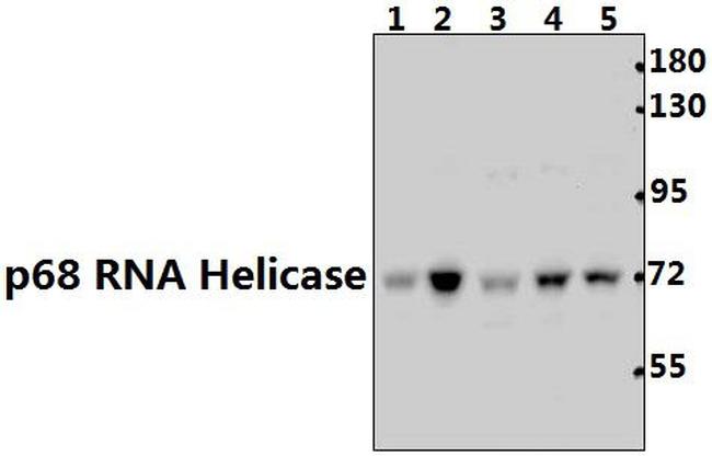 DDX5 Antibody in Western Blot (WB)