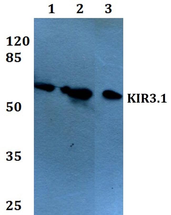 Kir3.1 (KCNJ3) Antibody in Western Blot (WB)