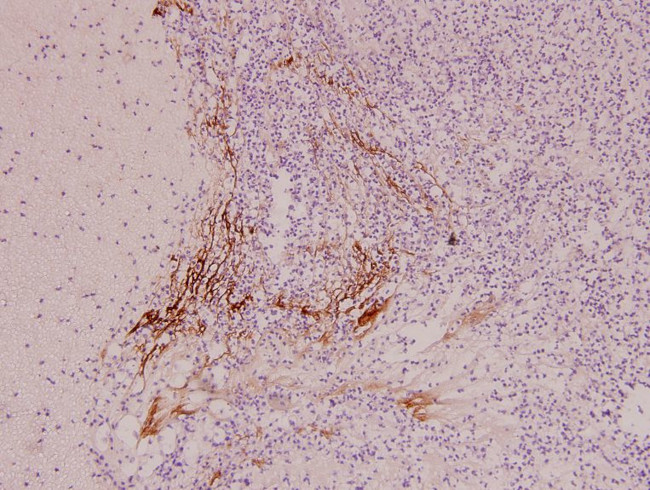 IL9R Antibody in Immunohistochemistry (Paraffin) (IHC (P))