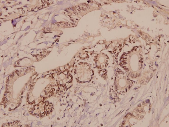 TGFBR2 Antibody in Immunohistochemistry (Paraffin) (IHC (P))